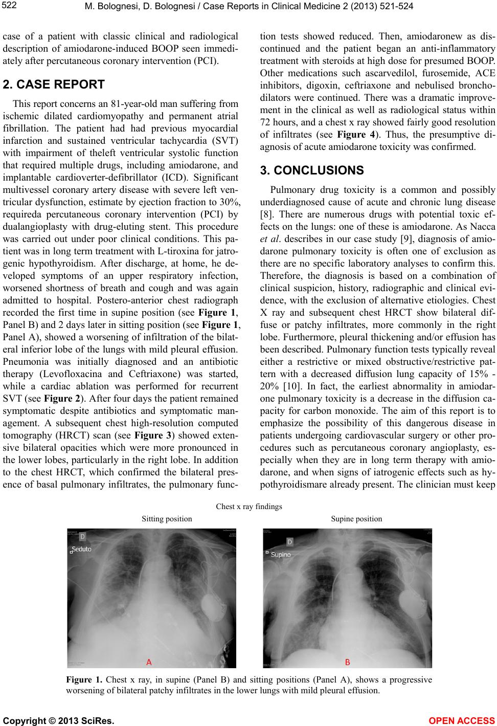 Tricular Amiodarone-induced bronchiolitis obliterans organizing pneumonia in ...