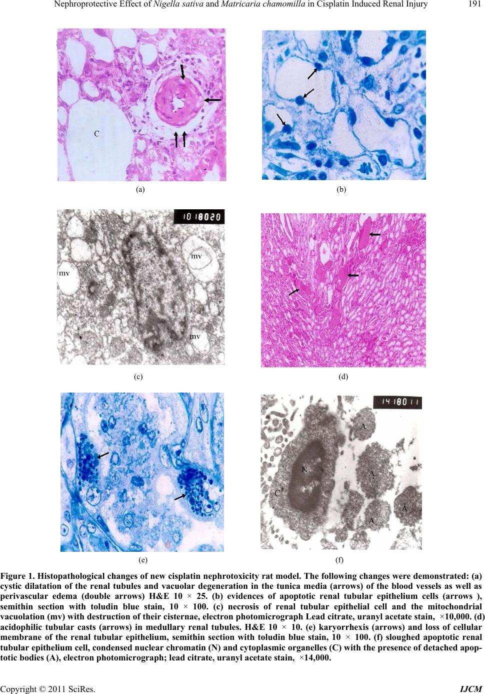 Nephroprotective Effect of Nigella Sativa and Matricaria Chamomilla in ...